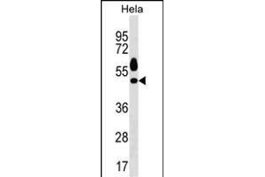 Mouse Sgk1 Antibody (C-term) (ABIN1537130 and ABIN2850307) western blot analysis in Hela cell line lysates (35 μg/lane). (SGK1 Antikörper  (C-Term))