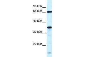 WB Suggested Anti-Klhl12 Antibody   Titration: 1. (KLHL12 Antikörper  (N-Term))