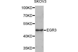 Western blot analysis of extracts of SKOV3 cells, using EGR3 antibody (ABIN5975619) at 1/1000 dilution. (EGR3 Antikörper)