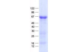 Validation with Western Blot (WT1 Protein (His tag))