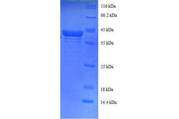 RPS16 Protein (AA 2-142, partial) (GST tag)