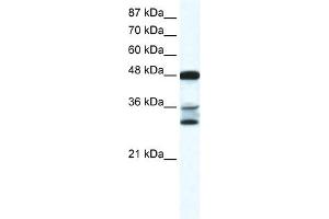 WB Suggested Anti-TNFSF10 Antibody Titration:  0. (TRAIL Antikörper  (N-Term))