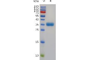 TPSAB1 Protein (AA 19-275) (His tag)