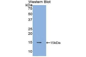 Western Blotting (WB) image for anti-POTE Ankyrin Domain Family, Member J (POTEJ) (AA 109-269) antibody (ABIN1171897) (POTEJ Antikörper  (AA 109-269))