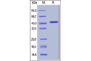 Biotinylated Human IL-2, Fc,Avitag on  under reducing (R) condition. (IL-2 Protein (AA 21-153) (Fc Tag,AVI tag,Biotin))