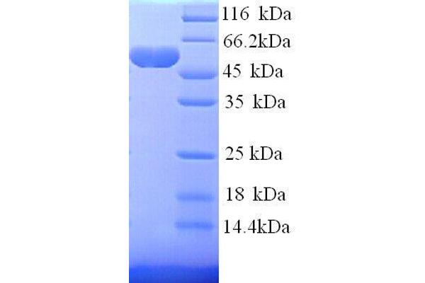 Hexokinase 1 Protein (HK1) (AA 1-485) (His tag)