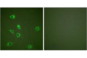 Immunofluorescence analysis of NIH/3T3 cells, using Glucagon antibody (ABIN5976409). (Glucagon Antikörper  (Internal Region))