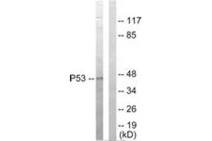 Western blot analysis of extracts from HepG2 cells, using p53 Antibody. (p53 Antikörper  (AA 301-350))