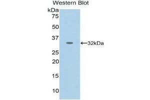 Western Blotting (WB) image for anti-Nestin (NES) (AA 178-399) antibody (ABIN1859982) (Nestin Antikörper  (AA 178-399))