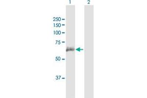 Western Blot analysis of ANTXR2 expression in transfected 293T cell line by ANTXR2 MaxPab polyclonal antibody. (ANTXR2 Antikörper  (AA 1-488))