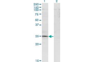 Western Blot analysis of TGIF2 expression in transfected 293T cell line by TGIF2 monoclonal antibody (M15A), clone 2A4. (TGIF2 Antikörper  (AA 1-237))