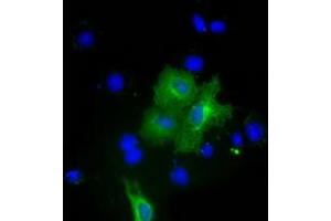 Anti-PKLR mouse monoclonal antibody (ABIN2453474) immunofluorescent staining of COS7 cells transiently transfected by pCMV6-ENTRY PKLR (RC206455). (PKLR Antikörper)