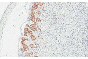 Immunohistochemistry (IHC) image for anti-TLR4 /MD2 Complex antibody (ABIN2665420) (TLR4 /MD2 Complex Antikörper)