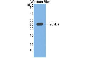 Western Blotting (WB) image for anti-Ubiquitin Carboxyl-terminal Esterase L1 (Ubiquitin Thiolesterase) (UCHL1) (AA 2-223) antibody (ABIN1078638) (UCHL1 Antikörper  (AA 2-223))