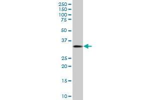 CDKN1B MaxPab polyclonal antibody. (CDKN1B Antikörper  (AA 1-198))