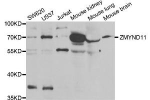 Western blot analysis of extracts of various cell lines, using ZMYND11 antibody (ABIN5973742) at 1/1000 dilution. (ZMYND11 Antikörper)