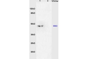 L1 mouse brain lysates, L2 mouse kidney lysates probed with Anti- TGF beta 2 Propeptide Polyclonal Antibody, Unconjugated (ABIN724880) at 1:200 in 4 °C. (TGF beta 2 Propeptide (AA 154-197) Antikörper)