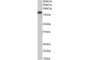 ABIN5539628 (1µg/ml) staining of MCF7 nuclear lysate (35µg protein in RIPA buffer). (Coilin Antikörper  (AA 73-86))