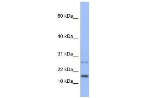 WB Suggested Anti-EDF1 Antibody Titration:  0. (EDF1 Antikörper  (N-Term))
