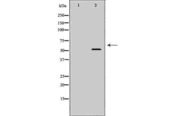 INA Antikörper  (Internal Region)