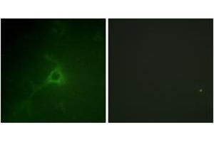 Immunofluorescence analysis of COS7 cells, using GFAP (Ab-38) Antibody. (GFAP Antikörper  (AA 11-60))