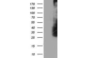 HEK293T cells were transfected with the pCMV6-ENTRY control (Left lane) or pCMV6-ENTRY LDLRAP1 (Right lane) cDNA for 48 hrs and lysed. (LDLRAP1 Antikörper)