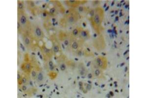 Used in DAB staining on fromalin fixed paraffin-embedded Liver tissue (Desmin Antikörper  (AA 117-348))