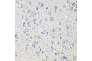 Immunohistochemistry of paraffin-embedded mouse brain using CD97 antibody (ABIN5971965) at dilution of 1/100 (40x lens). (CD97 Antikörper)