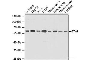 Western blot analysis of extracts of various cells using STK4 Polyclonal Antibody at dilution of 1:1000. (STK4 Antikörper)