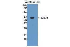 Western Blotting (WB) image for anti-Vasorin (Vasn) (AA 298-539) antibody (ABIN1872181) (Vasn Antikörper  (AA 298-539))