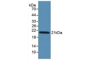 Detection of Recombinant MASP2, Human using Monoclonal Antibody to Mannose Associated Serine Protease 2 (MASP2) (Mannose Associated Serine Protease 2 (AA 280-433) Antikörper)