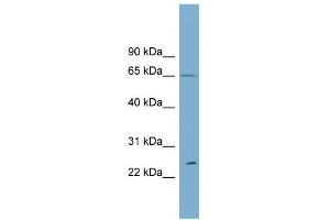 WB Suggested Anti-RPN2 Antibody Titration:  0. (Ribophorin II Antikörper  (Middle Region))