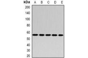 Western blot analysis of RABIN3 expression in Hela (A), A549 (B), mouse kidney (C), mouse liver (D), rat brain (E) whole cell lysates. (RAB3IP Antikörper)