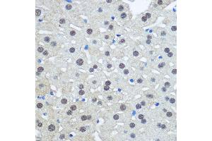 Immunohistochemistry of paraffin-embedded Rat liver using UB antibody (2359) at dilution of 1:100 (40x lens). (UBA1 Antikörper  (AA 300-600))