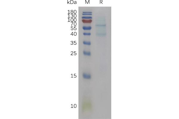 BMP6 Protein (AA 21-510) (His tag)