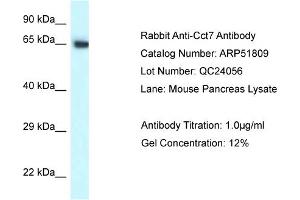 Western Blotting (WB) image for anti-Chaperonin Containing TCP1, Subunit 7 (Eta) (CCT7) (C-Term) antibody (ABIN970320) (CCT7 Antikörper  (C-Term))