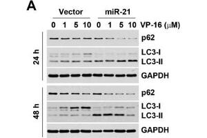 Western Blotting (WB) image for anti-Sequestosome 1 (SQSTM1) antibody (ABIN2854836)