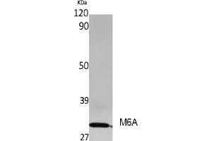 Western Blot analysis of extracts from rat stomach, using M6A Polyclonal Antibody. (METTL3 Antikörper  (AA 140-220))