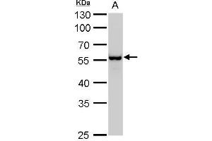 Western Blotting (WB) image for anti-Vimentin (VIM) antibody (ABIN2854814)