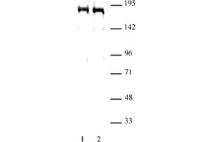 DNMT1 antibody (pAb) tested by Western blot. (DNMT1 Antikörper  (AA 1-110))
