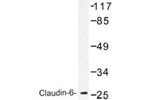 Image no. 2 for anti-Claudin 6 (CLDN6) antibody (ABIN317829) (Claudin 6 Antikörper)