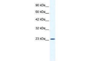 KCTD11 antibody used at 1. (KCTD11 Antikörper  (N-Term))