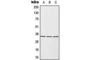 Western blot analysis of HUR expression in HeLa (A), Ramos (B), Jurkat (C) whole cell lysates. (ELAVL1 Antikörper  (Center))