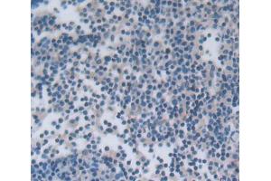 Used in DAB staining on fromalin fixed paraffin- embedded lymph node tissue (NCR1 Antikörper  (AA 17-211))