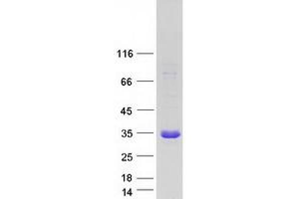 CHAC1 Protein (Transcript Variant 1) (Myc-DYKDDDDK Tag)