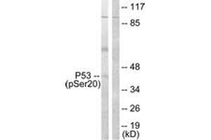 Western blot analysis of extracts from COS7 cells treated with UV 5', using p53 (Phospho-Ser20) Antibody. (p53 Antikörper  (pSer20))