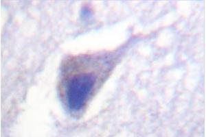 Image no. 2 for anti-Dynamin 1 (DNM1) antibody (ABIN271884) (Dynamin 1 Antikörper)