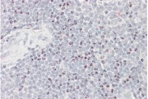 Immunohistochemistry (IHC) image for anti-Large Proline-Rich Protein BAT3 (BAT3) antibody (ABIN5926991) (BAT3 Antikörper)