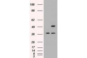 HEK293T cells were transfected with the pCMV6-ENTRY control (Left lane) or pCMV6-ENTRY CD4 (Right lane) cDNA for 48 hrs and lysed. (CD4 Antikörper)