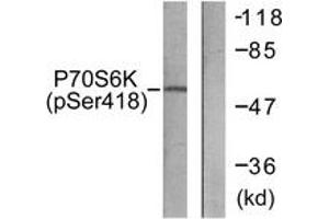 Western blot analysis of extracts from HT29 cells treated with serum 20% 15', using p70 S6 Kinase (Phospho-Ser418) Antibody. (RPS6KB1 Antikörper  (pSer418))
